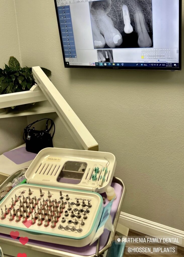 Dental Implants in Panorama City